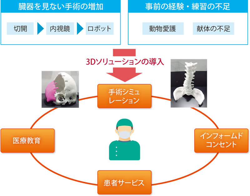 画像：医療業界における3Dソリューション導入のメリット
